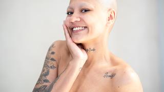 Emma (before-after long)